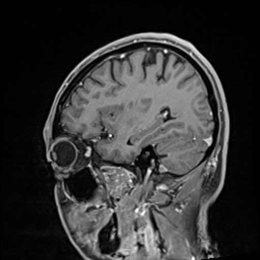 Click on the Serie image to view the images of VILLANUEVA, WILLIAM A.